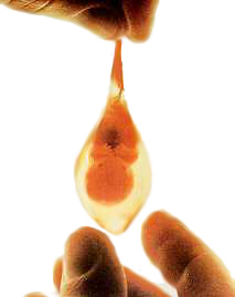 fetus in a teardrop shaped ornament